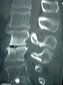 mid-lumbar-region