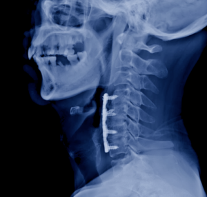 Don’t Underestimate the Risks of Surgery